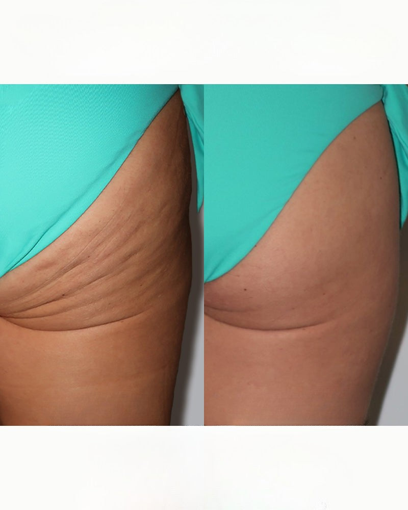 VibeWell CelluFlow™