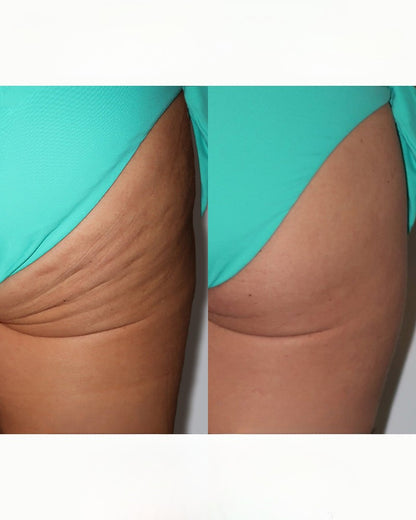 VibeWell CelluFlow™