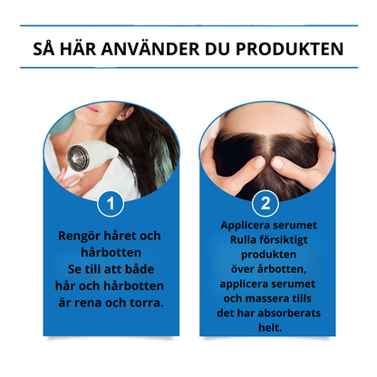 HOEGOA - Hårroller med Rosmarin & Ingefära – För naturlig hårväxt