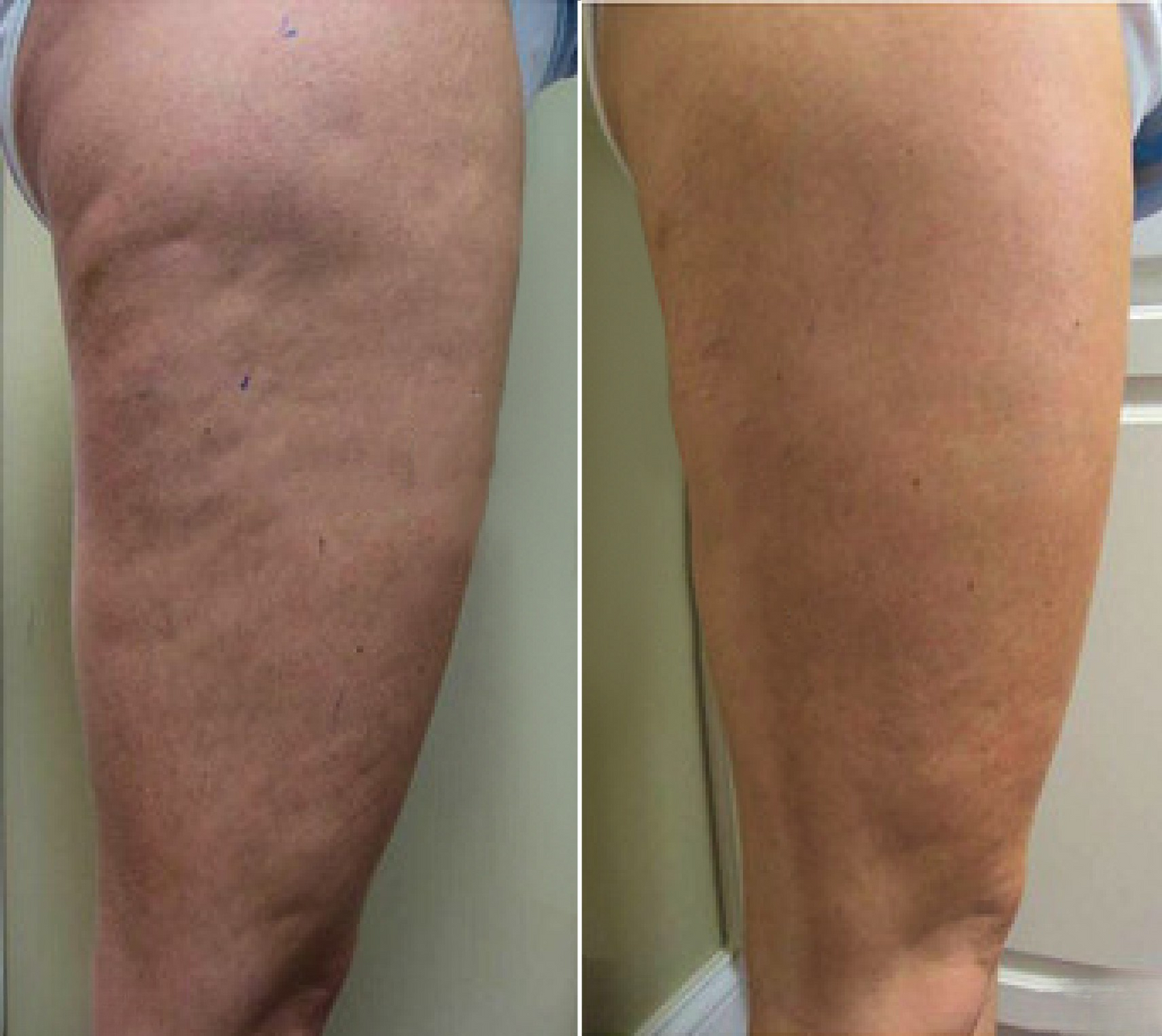 VibeWell CelluFlow™