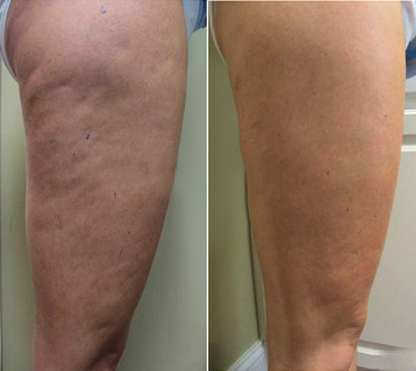 VibeWell CelluFlow™